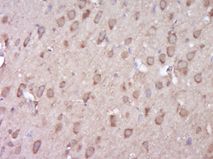 Fig1: Paraformaldehyde-fixed, paraffin embedded (Rat brain); Antigen retrieval by boiling in sodium citrate buffer (pH6.0) for 15min; Block endogenous peroxidase by 3% hydrogen peroxide for 20 minutes; Blocking buffer (normal goat serum) at 37℃ for 30min; Antibody incubation with (C6ORF199) Polyclonal Antibody, Unconjugated at 1:400 overnight at 4℃, followed by operating according to SP Kit(Rabbit) (sp-0023) instructions and DAB staining.
