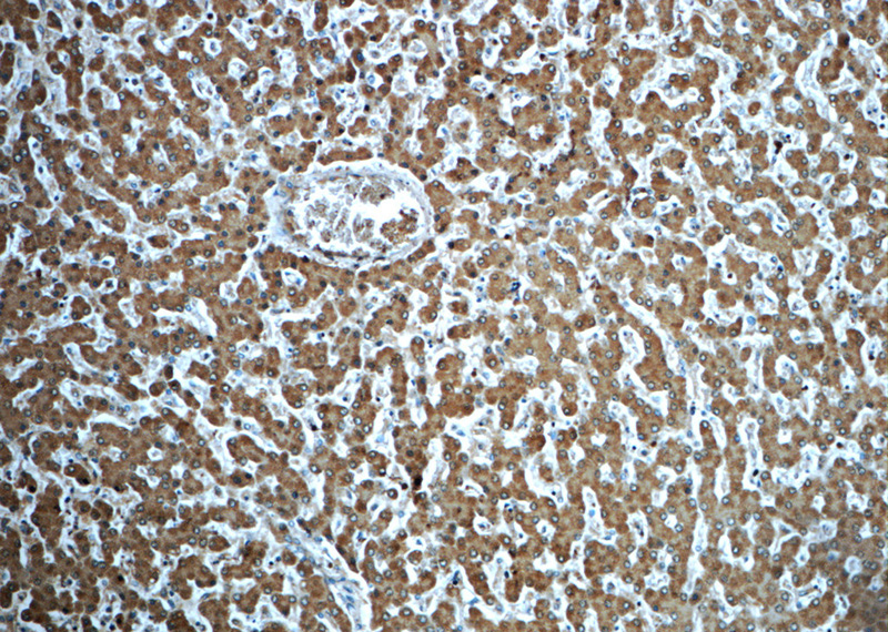 Immunohistochemistry of paraffin-embedded human liver slide using Catalog No:107790(ADH7 Antibody) at dilution of 1:50