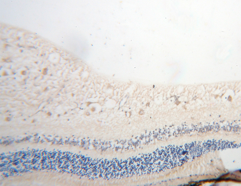 Immunohistochemical of paraffin-embedded human eye using Catalog No:111979(KCNS2 antibody) at dilution of 1:100 (under 10x lens)