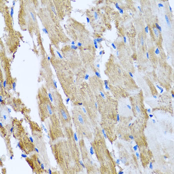 Immunohistochemistry - CCM2 Polyclonal Antibody 