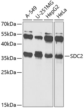 Western blot - SDC2 Polyclonal Antibody 
