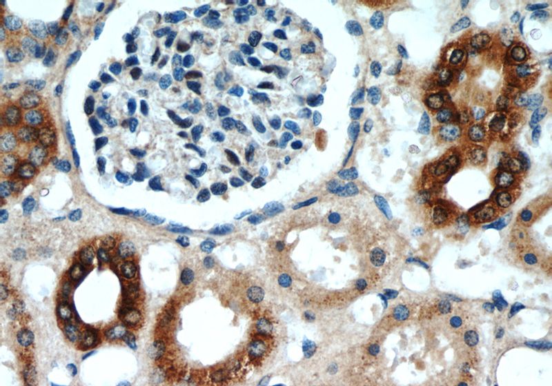 Immunohistochemistry of paraffin-embedded human kidney slide using Catalog No:108058(ANGPTL4 Antibody) at dilution of 1:50