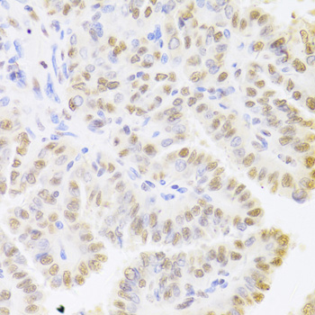 Immunohistochemistry - HDGF Polyclonal Antibody 