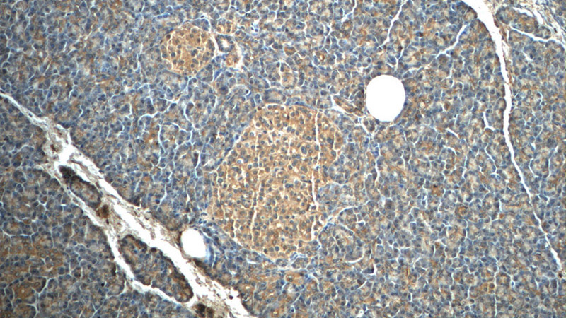Immunohistochemistry of paraffin-embedded human pancreas tissue slide using Catalog No:107394(IL23A Antibody) at dilution of 1:50 (under 40x lens)