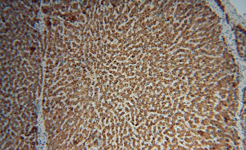 Immunohistochemical of paraffin-embedded human liver using Catalog No:107703(ACSS3 antibody) at dilution of 1:100 (under 10x lens)
