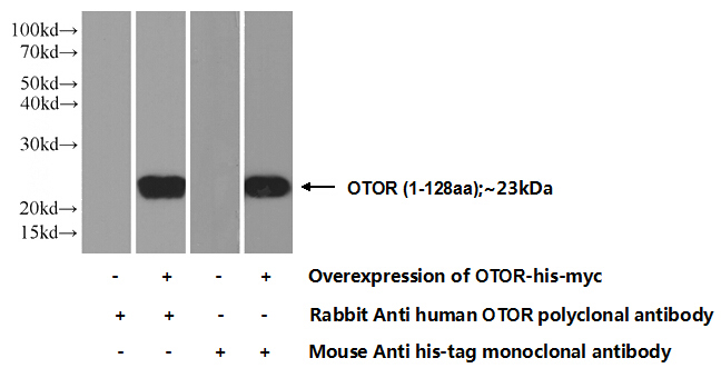 Transfected HEK-293 cells were subjected to SDS PAGE followed by western blot with Catalog No:113513(OTOR Antibody) at dilution of 1:1000