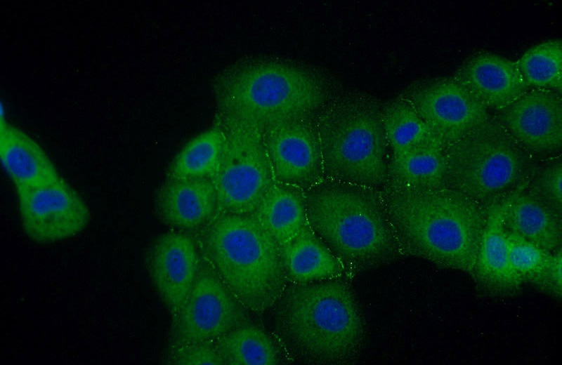 Immunofluorescent analysis of A431 cells using Catalog No:109317(CGN Antibody) at dilution of 1:25 and Alexa Fluor 488-congugated AffiniPure Goat Anti-Rabbit IgG(H+L)
