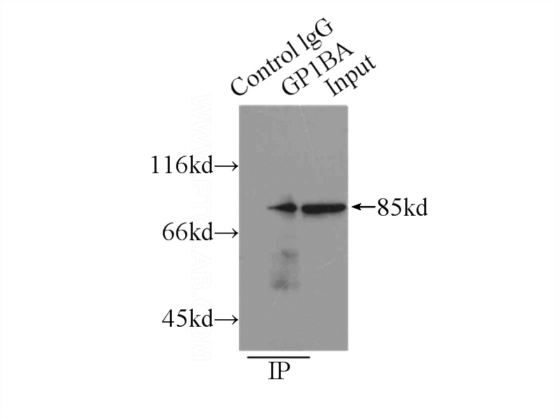 IP Result of anti-GP1BA (IP:Catalog No:109122, 3ug; Detection:Catalog No:109122 1:500) with A431 cells lysate 3000ug.