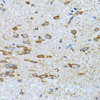 Immunohistochemistry - PDP1 Polyclonal Antibody 
