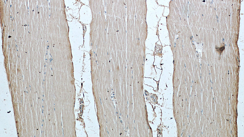 Immunohistochemistry of paraffin-embedded human skeletal muscle slide using Catalog No:107373(LC3A/B Antibody) at dilution of 1:50