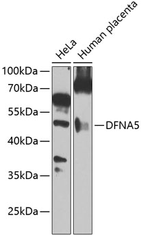 Western blot - DFNA5 Polyclonal Antibody 