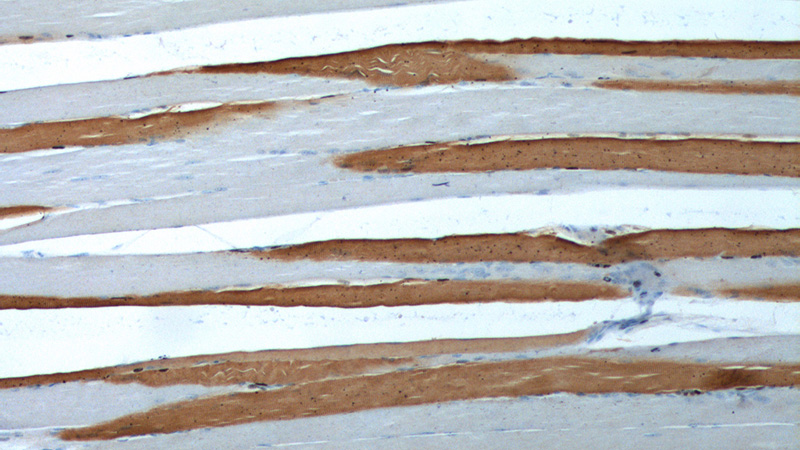 Immunohistochemistry of paraffin-embedded human skeletal muscle tissue slide using Catalog No:108347(ATP2A1 Antibody) at dilution of 1:200 (under 10x lens).