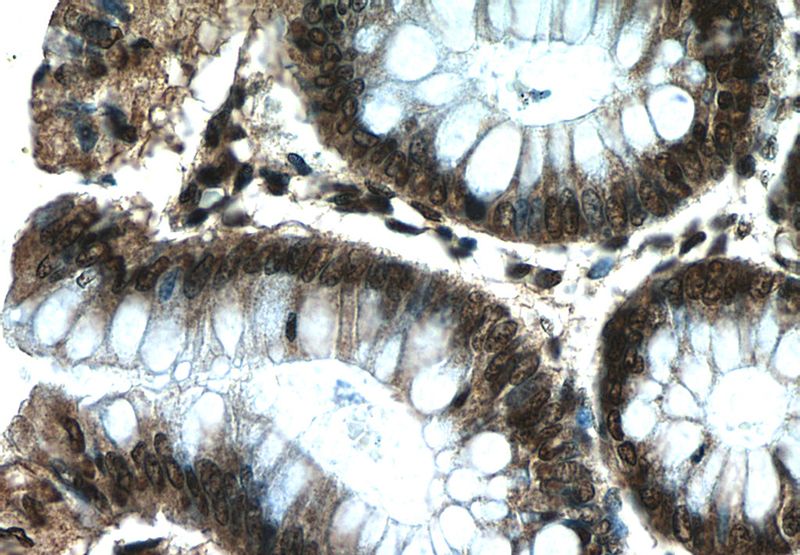 Immunohistochemistry of paraffin-embedded human colon tissue slide using Catalog No:111342(HIC1 Antibody) at dilution of 1:50 (under 40x lens)
