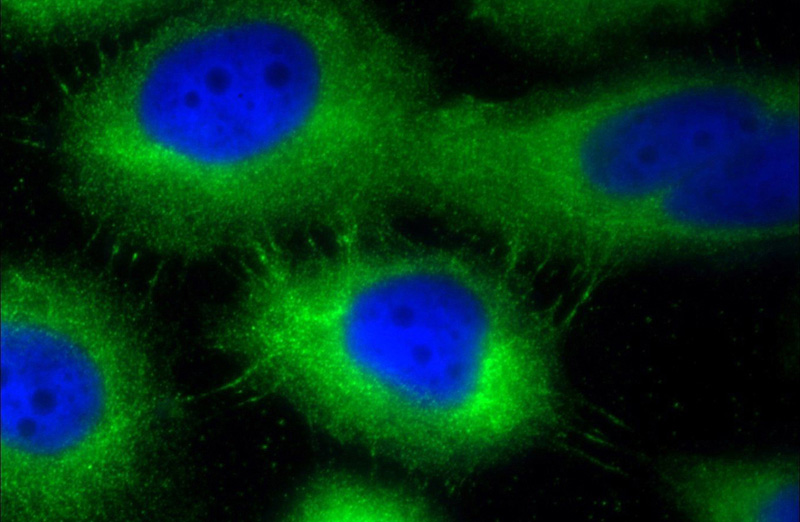 Immunofluorescent analysis of A431 cells using Catalog No:109899(DSP Antibody) at dilution of 1:25 and Alexa Fluor 488-congugated AffiniPure Goat Anti-Rabbit IgG(H+L)