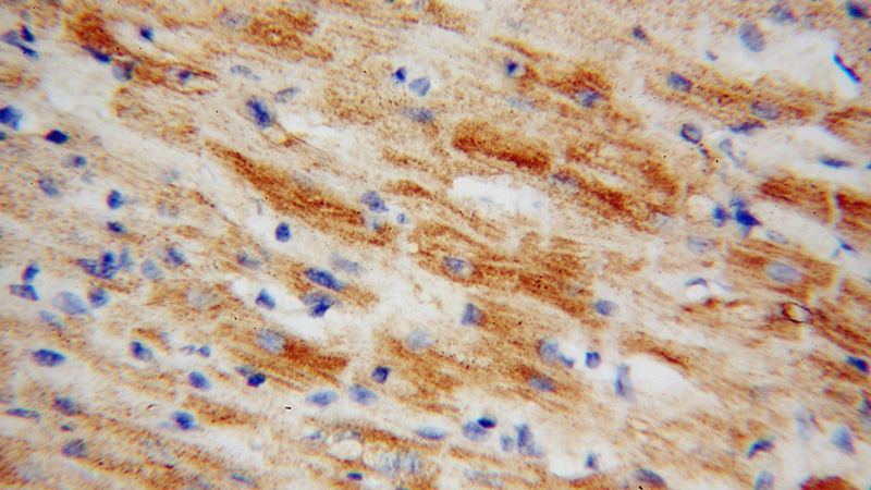 Immunohistochemical of paraffin-embedded human heart using Catalog No:113083(NDUFS5 antibody) at dilution of 1:50 (under 40x lens)