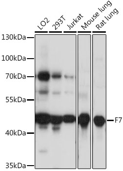 Western blot - F7 Polyclonal Antibody 
