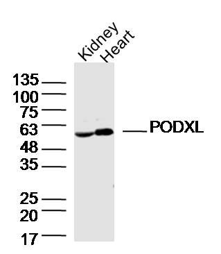Fig1: Sample:; Kidney(Mouse)Lysate at 40 ug; Heart (Mouse)Lysate at 40 ug; Primary: Anti-PODXL at 1/300 dilution; Secondary: IRDye800CW Goat Anti-RabbitIgG at 1/20000 dilution; Predicted band size: 59kD; Observed band size: 59kD