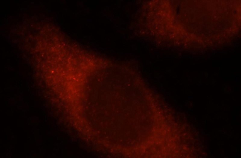 Immunofluorescent analysis of MCF-7 cells, using OXSR1 antibody Catalog No:113529 at 1:25 dilution and Rhodamine-labeled goat anti-rabbit IgG (red).