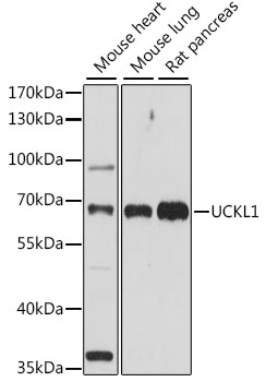 Western blot - UCKL1 Polyclonal Antibody 