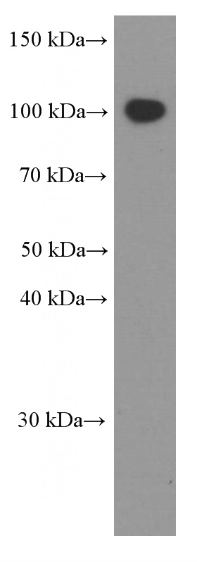 human spleen tissue were subjected to SDS PAGE followed by western blot with Catalog No:107537(VCAM-1 Antibody) at dilution of 1:800