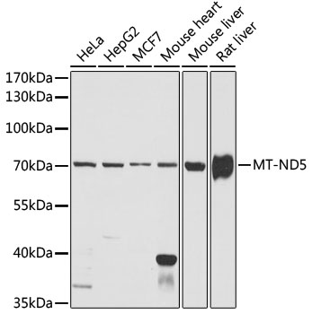 Western blot - MT-ND5 Polyclonal Antibody 