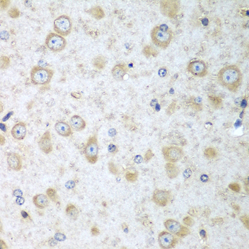 Immunohistochemistry - TRH Polyclonal Antibody 