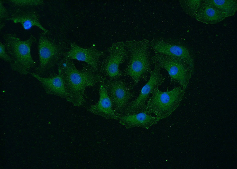 Immunofluorescent analysis of (-20oc Ethanol) fixed SH-SY5Y cells using Catalog No:108915(CAMK2A-Specific Antibody) at dilution of 1:50 and Alexa Fluor 488-congugated AffiniPure Goat Anti-Rabbit IgG(H+L)
