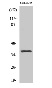 Fig1:; Western Blot analysis of various cells using Olfactory receptor 5K1 Polyclonal Antibody