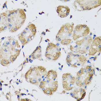 Immunohistochemistry - USH1C Polyclonal Antibody 