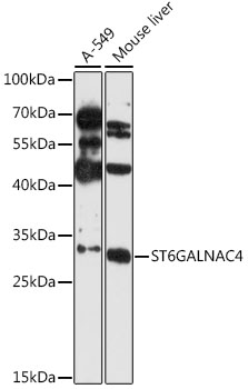 Western blot - ST6GALNAC4 Polyclonal Antibody 