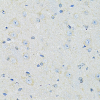 Immunohistochemistry - SLC22A5 Polyclonal Antibody 
