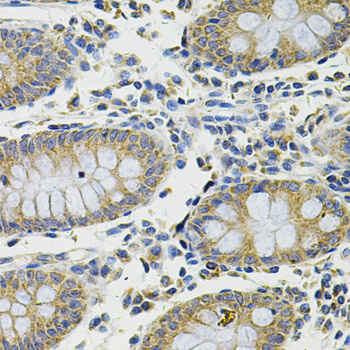 Immunohistochemistry - DDX20 Polyclonal Antibody 