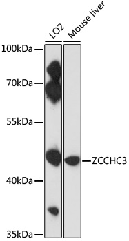 Western blot - ZCCHC3 Polyclonal Antibody 