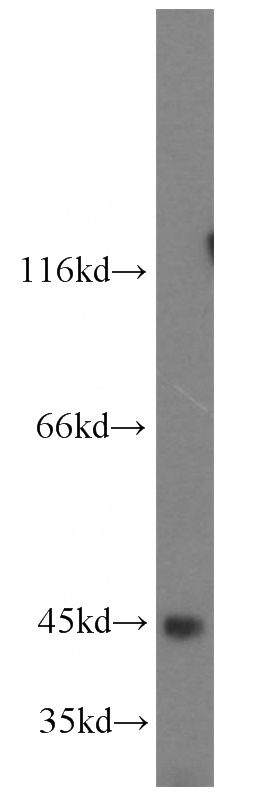 HEK-293 cells were subjected to SDS PAGE followed by western blot with Catalog No:112506(MBIP antibody) at dilution of 1:300