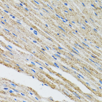 Immunohistochemistry - MYOT Polyclonal Antibody 