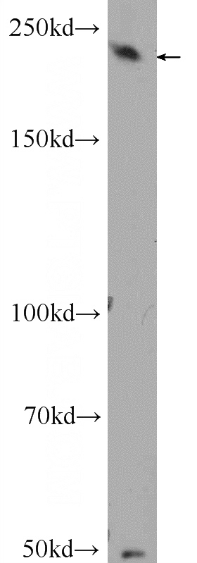 A431 cells were subjected to SDS PAGE followed by western blot with Catalog No:110416(EXPH5 Antibody) at dilution of 1:300