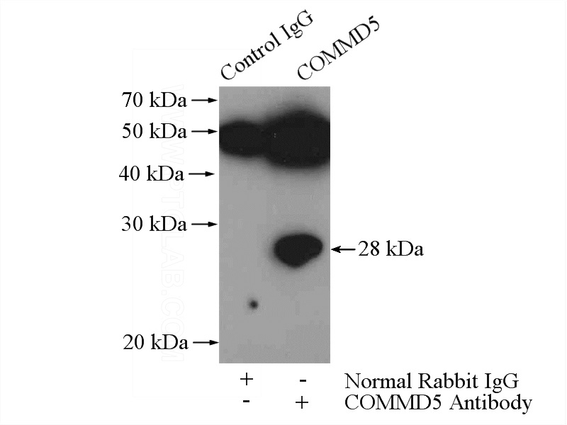 IP Result of anti-COMMD5 (IP:Catalog No:109444, 4ug; Detection:Catalog No:109444 1:500) with mouse heart tissue lysate 3200ug.