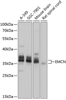 Western blot - EMCN Polyclonal Antibody 