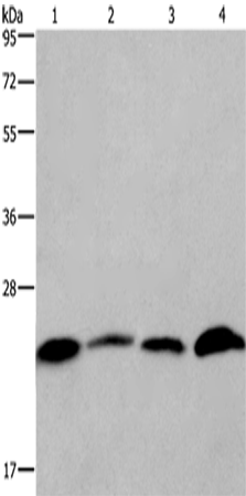 Gel: 10%SDS-PAGE, Lysate: 40 μg, Lane 1-4: Human placenta tissue, Human testis tissue, Hela cells, Raji cells, Primary antibody: 166797(CMTM6 Antibody) at dilution 1/700, Secondary antibody: Goat anti rabbit IgG at 1/8000 dilution, Exposure time: 3 minutes