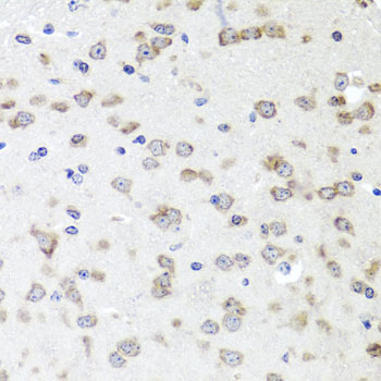 Immunohistochemistry - IGFBP5 Polyclonal Antibody 