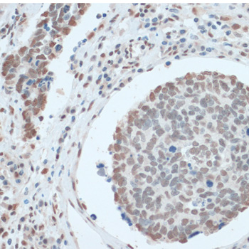 Immunohistochemistry - ZNF433 Polyclonal Antibody 