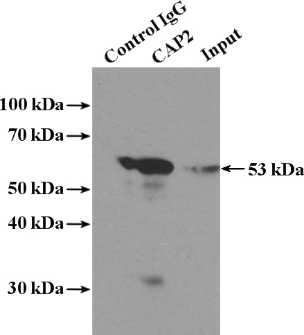 IP Result of anti-CAP2 (IP:Catalog No:108933, 4ug; Detection:Catalog No:108933 1:1000) with mouse testis tissue lysate 4000ug.