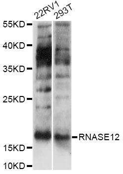 Western blot - RNASE12 Polyclonal Antibody 