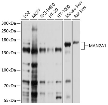 Western blot - MAN2A1 Polyclonal Antibody 