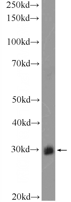 mouse liver tissue were subjected to SDS PAGE followed by western blot with Catalog No:117215(BPGM Antibody) at dilution of 1:1000