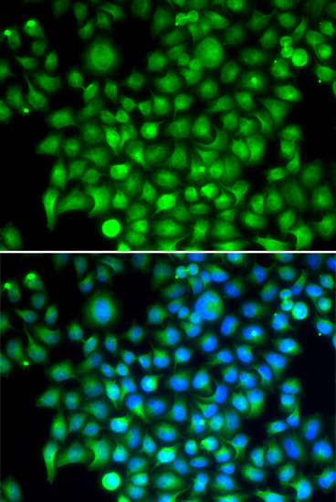 Immunofluorescence - CFI Polyclonal Antibody 