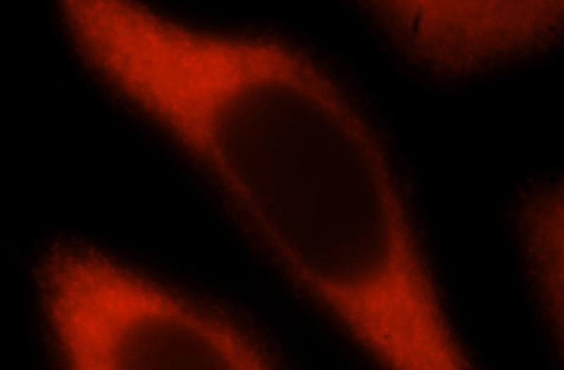 Immunofluorescent analysis of Hela cells, using TBCB antibody Catalog No:115870 at 1:25 dilution and Rhodamine-labeled goat anti-rabbit IgG (red).
