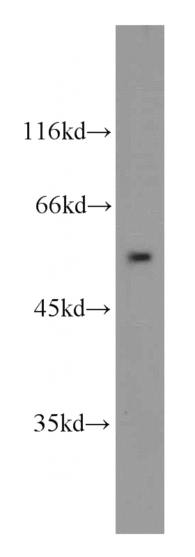 HepG2 cells were subjected to SDS PAGE followed by western blot with Catalog No:113981(PNPLA3 antibody) at dilution of 1:100