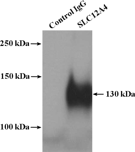 IP Result of anti-SLC12A4 (IP:Catalog No:115299, 4ug; Detection:Catalog No:115299 1:500) with HeLa cells lysate 3200ug.