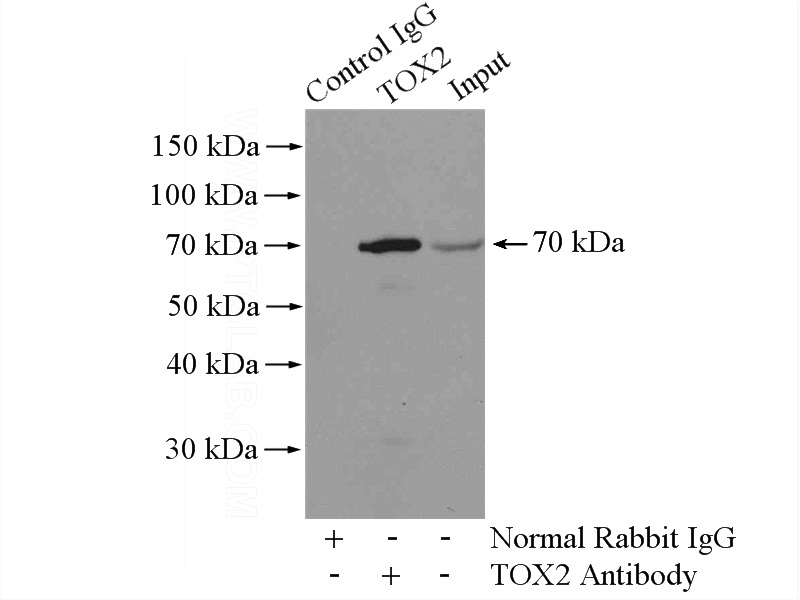 IP Result of anti-TOX2 (IP:Catalog No:116257, 4ug; Detection:Catalog No:116257 1:300) with mouse liver tissue lysate 4000ug.